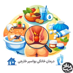 درمان خانگی بواسیر خارجی بر پایه کاهش التهاب، کنترل درد و اصلاح عوامل زمینهساز انجام میشود. این رویکرد برای موارد خفیف تا متوسط مناسب است