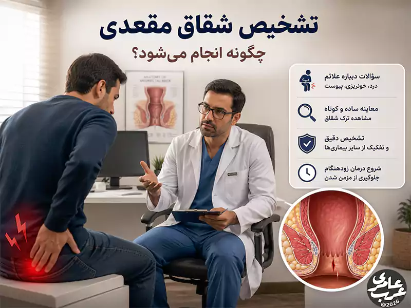 تشخیص شقاق مقعدی چگونه انجام میشود؟