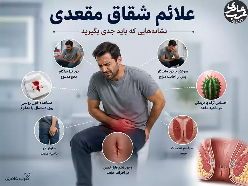 علائم شقاق مقعدی