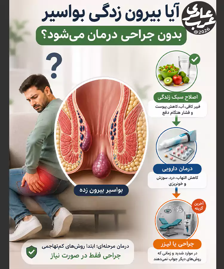 تصویر آموزشی درمان بیرون زدگی بواسیر بدون جراحی با اصلاح سبک زندگی، درمان دارویی و بررسی مرحلهای نیاز به لیزر یا جراحی