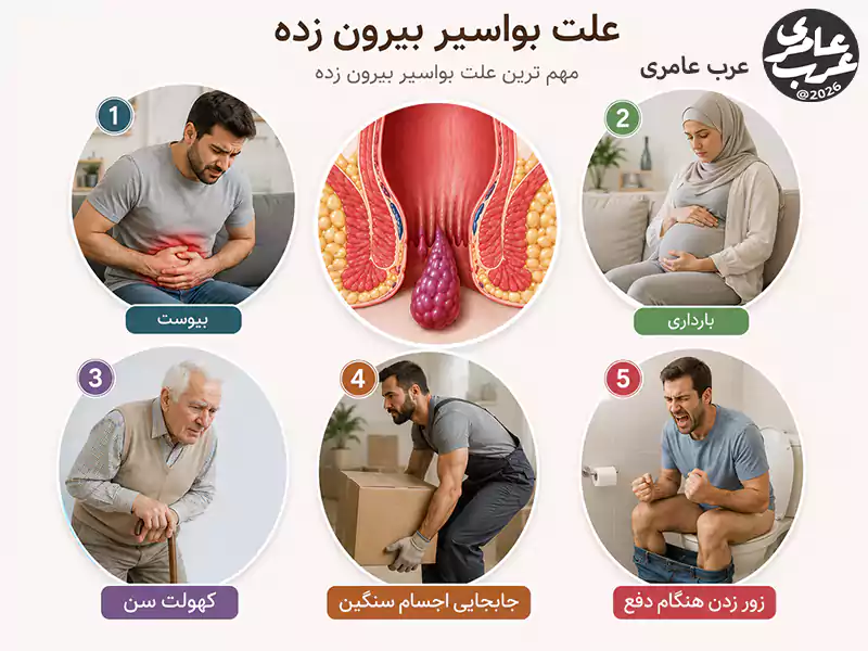 مهمترین علت بیرون زدگی بواسیر افزایش فشار در ناحیه شکم و لگن است. عواملی مانند یبوست، زور زدن هنگام دفع، بارداری، افزایش سن و برخی عادتهای نادرست روزمره میتوانند این روند را تشدید کنند