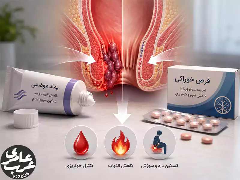 مقایسه پماد و قرص برای درمان و کنترل علائم بواسیر خونی