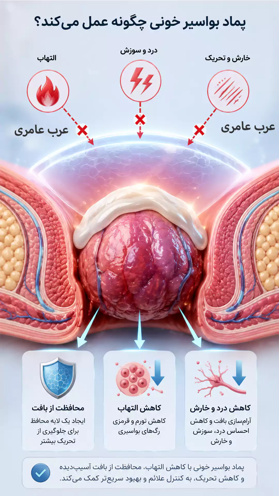 مکانیسم اثر پماد بواسیر خونی و محافظت از بافت ملتهب هموروئید