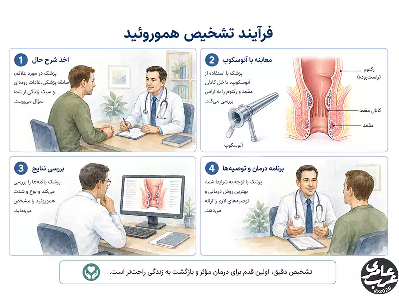 تشخیص بواسیر داخلی