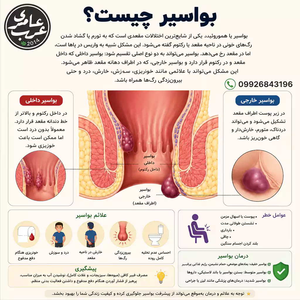 بواسیر یا هموروئید یکی از شایعترین اختلالات مقعدی است که به تورم یا گشاد شدن رگهای خونی در ناحیه مقعد یا رکتوم گفته میشود. این وضعیت شبیه به واریس در پاها است، اما در مقعد رخ میدهد.